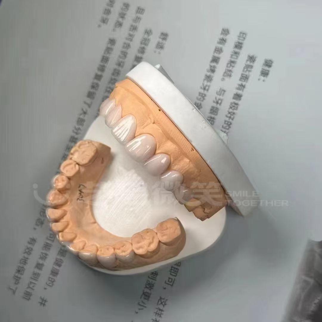 丰润区西安窝沟封闭价格