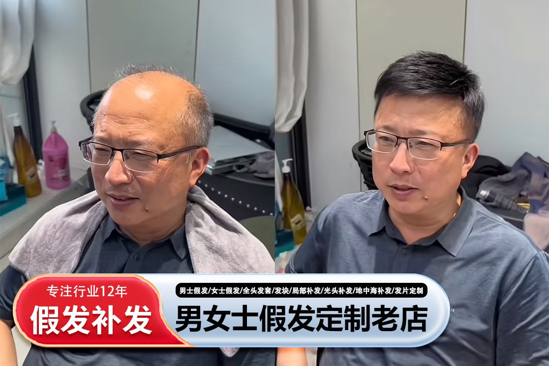 圆脸假发套定制参考