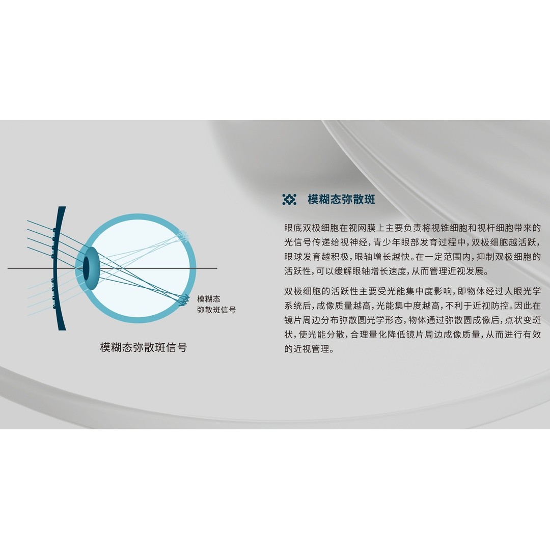 青少年视力建档与复查流程